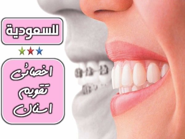 مطلوب اخصائي تقويم اسنان  بالسعودية 