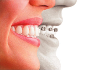 اقوى العروض والخصومات تقدمها لكم مراكز dcare لطب الاسنان 