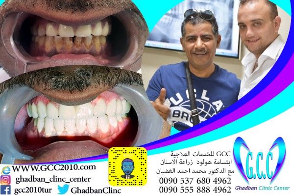 مركز الاسنان الاول في تركيا  gcc